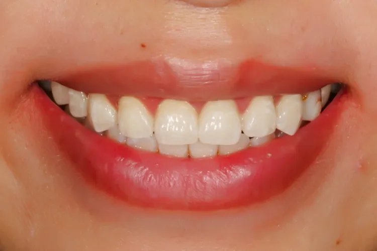 人的五官指什么部位