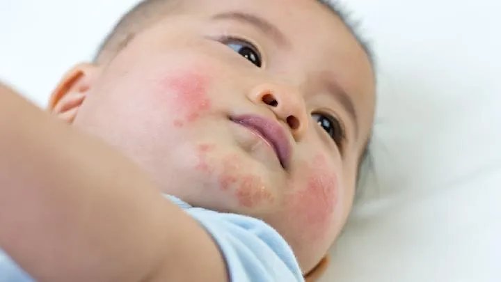 手足口病症状初期图片？手足口病的主要传染源有哪些？