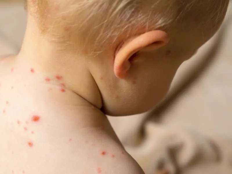 三个月的宝宝训练趴睡窒息身亡，宝宝窒息了应该怎么办？