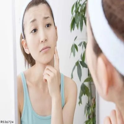 怎样去除青春痘印 这几招去除青春痘印超有效