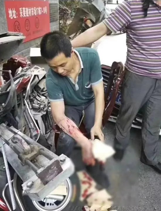 干部驾奥迪车撞伤农民工是故意的吗？