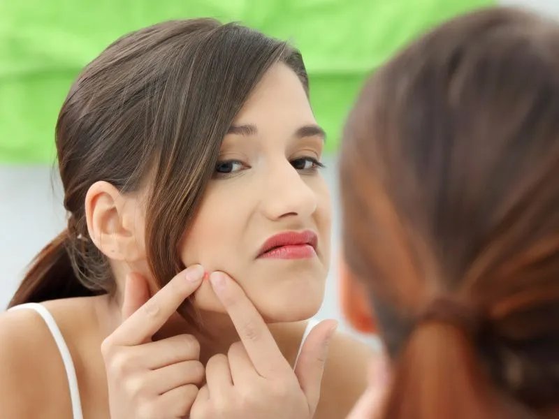 如何快速去除痤疮