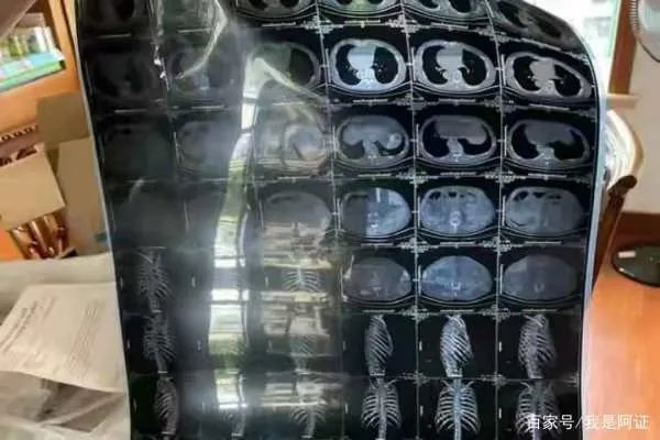 上海夫妻为报复邻居连开五年震楼器，到底什么仇什么怨？