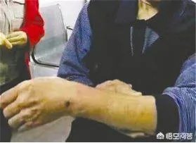 如何看待流浪狗24小时连伤22人，阆中全城捕狗事件？