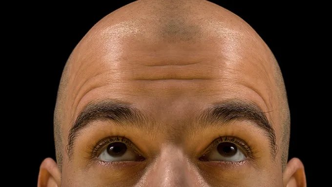 头发稀少怎么办