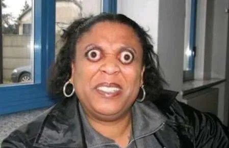 世界上眼球最突出的人——约翰·道尔(12毫米)