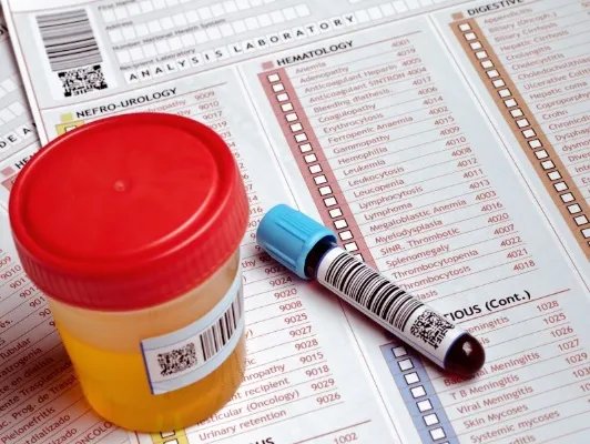 血型配对的注意事项