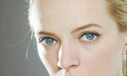 歪鼻矫正的费用大概多少