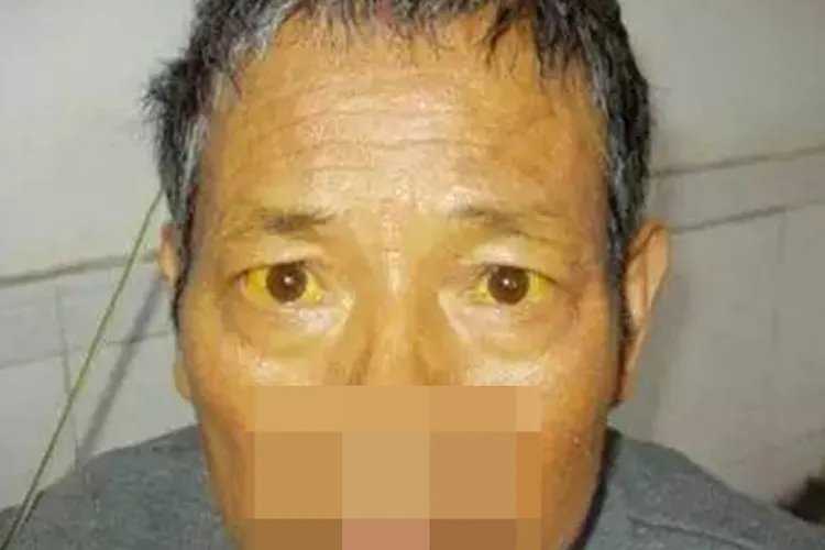 皮肤有什么症状图片