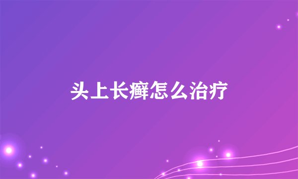 头上长癣怎么治疗