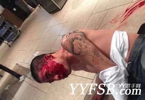 刘一手被打满脸血 IR刘一手被打现场图片