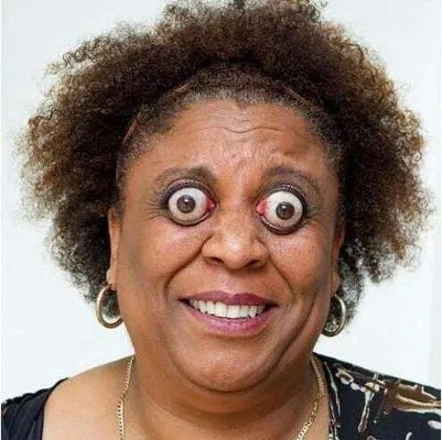 世界上眼球最突出的人——约翰·道尔(12毫米)