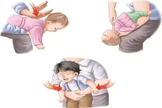 海姆立克急救法三步骤图解