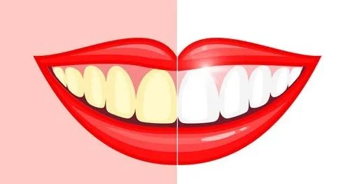 齿白金洗牙粉有害吗